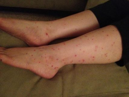 Scram Image Gallery Photo